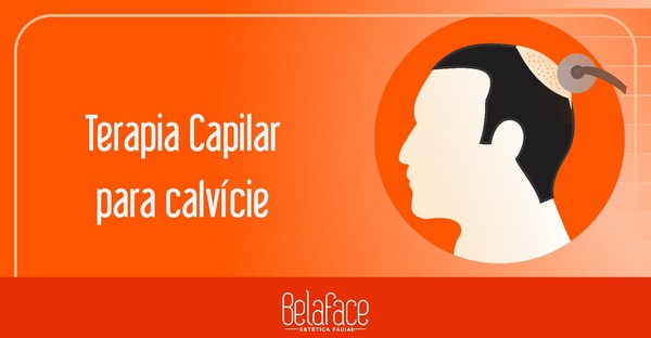 Terapia Capilar Calvície